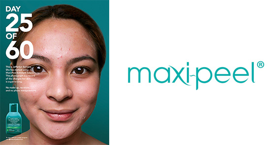 Maxi Peel 2.jpg