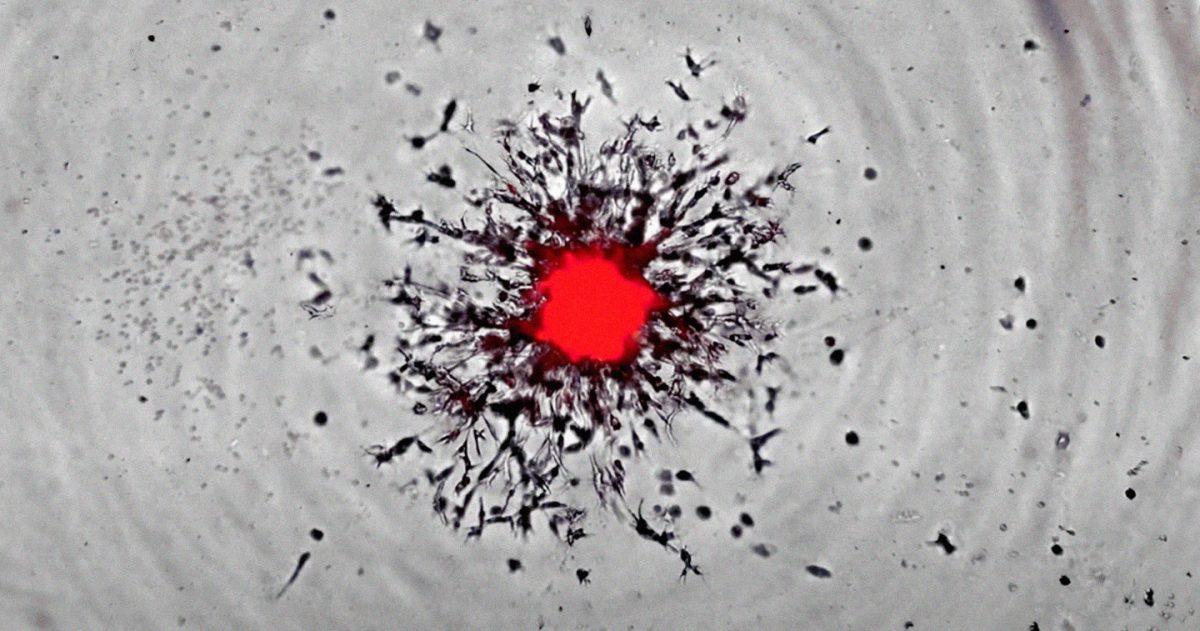 Gustave Roussy spotlights hero